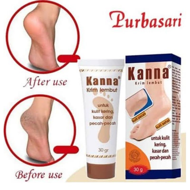Kanna Krim Lembut 30ml // Krim White 30 ml [[SIZE BESAR]] ORIGINAL-BPOM