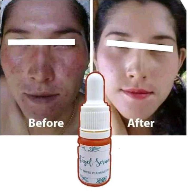 SERUM Pemutih kulit wajah/ Vitagel Serum halal & Bpom/ Ampuh menghilangkan flek hitam/ 15x pemakaian