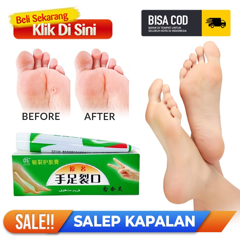 salep kaki pecah tumit dan kering cream hebal