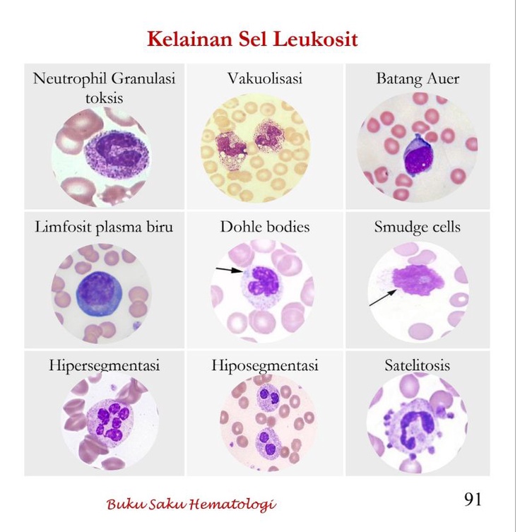 Buku Saku Hematologi