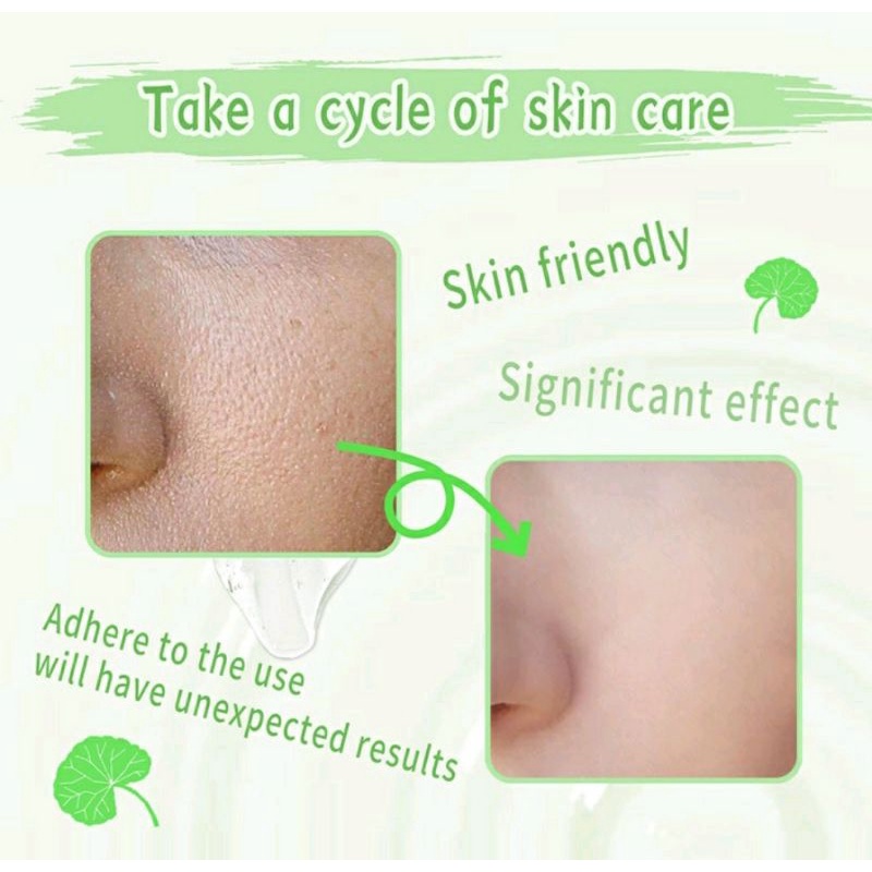 GIRLPAL CENTELLA ASIATICA PEELING GEL | FACIAL EXFOLIATING | MENCERAHKAN WAJAH