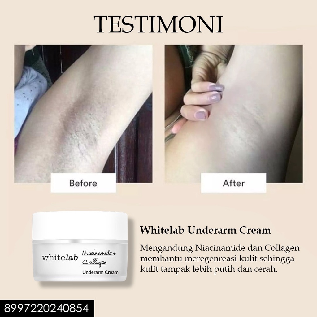 WHITELAB UNDERARM CREAM Krim Pencerah Ketiak Lutut Selangkangan Ampuh - BPOM