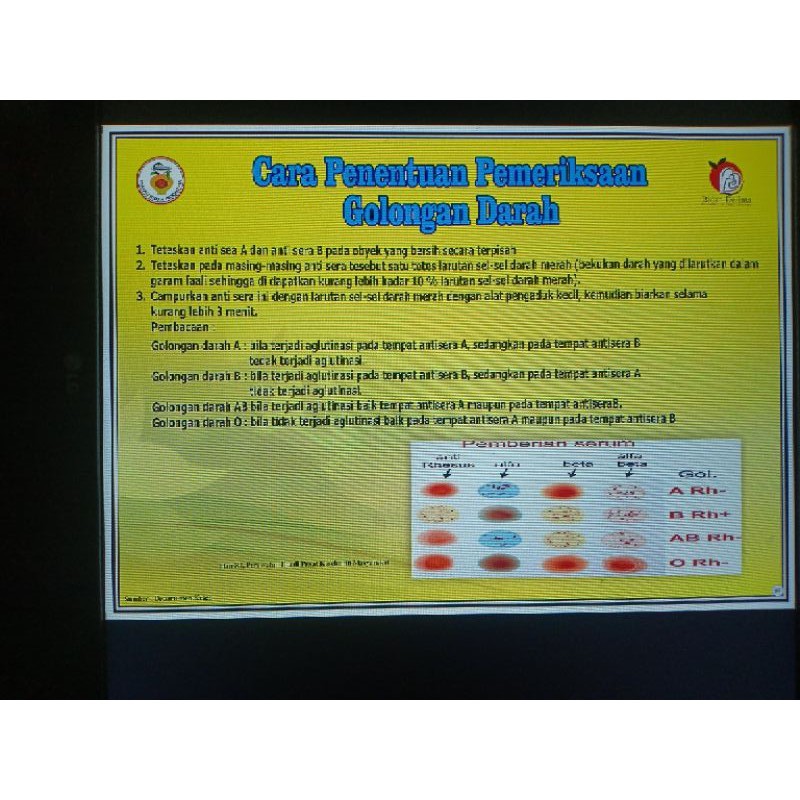 

POSTER CARA PENENTUAN PEMERIKSAAN GOLONGAN DARAH (87)