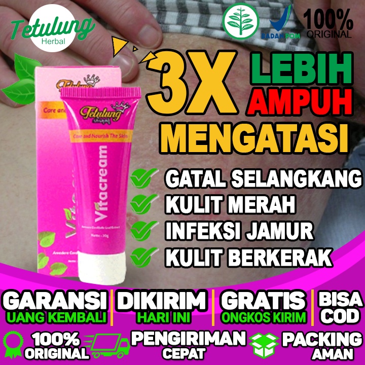 Obat Gatal Kulit Selangkangan Eksim Jamur Paling Ampuh Colobra Obat Kulit Herbal Panu Kurap Kudis Ku