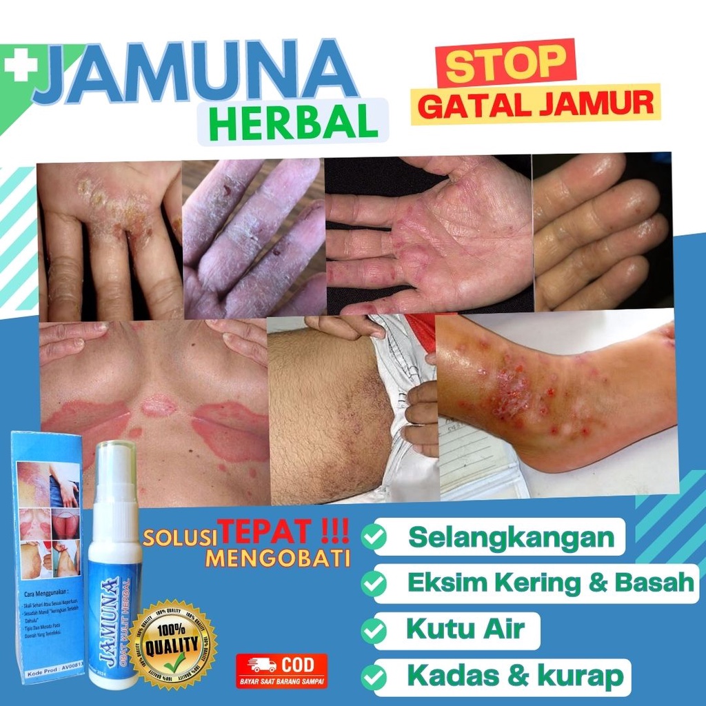 Obat Gatal Selangkangan Paling Ampuh Jamuna Herbal Aman Alami Tanpa Efek Sampin