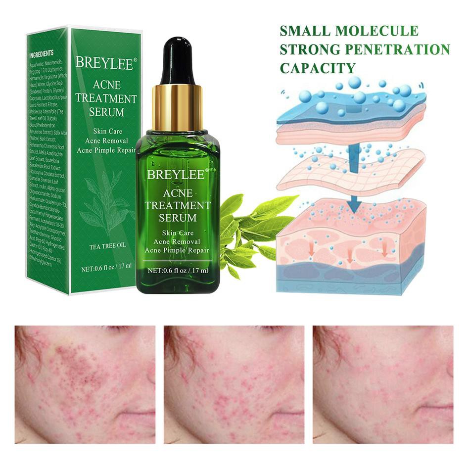BREYLEE  Acne Treatment Serum - Wajah Berjerawat (17ml)