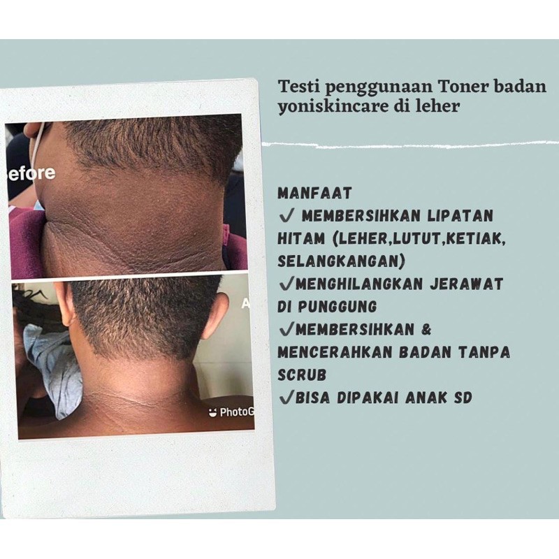 [BPOM]  YONI SKINCARE TONER BADAN PENGHILANG &amp; PEMBERSIH DAKI BADAN