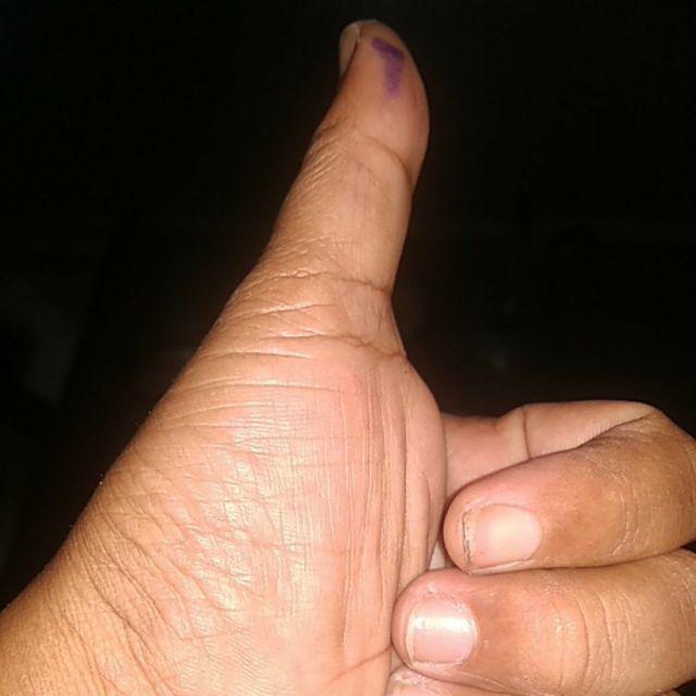 Baut Akrilik Pen Iklan Ukuran 18x25 Mm