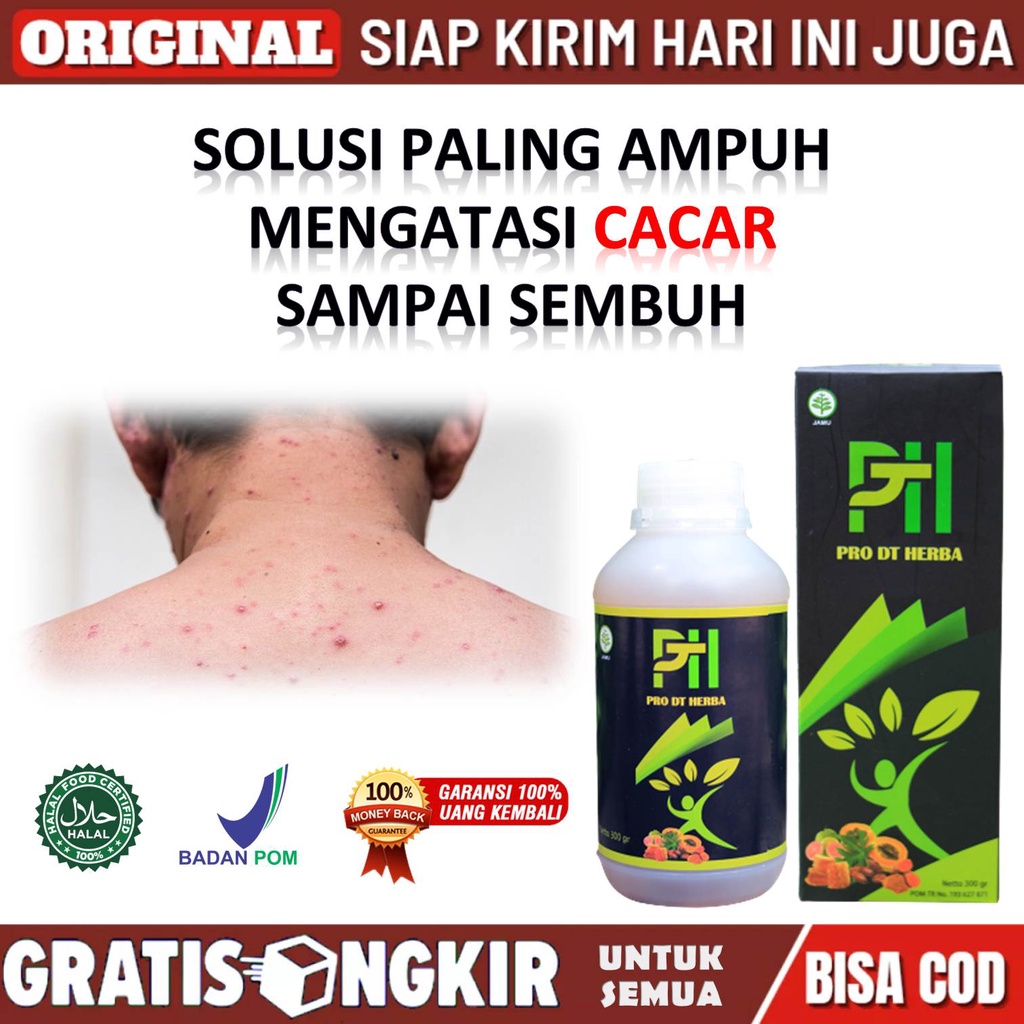 Obat Cacar Api - Obat Cacar Air Dewasa - Obat Cacar Ular - Obat Cacar Anak - Obat Cacar Dan Bekasnya