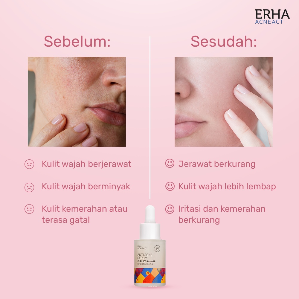 ERHA Serum Wajah AcneAct Anti Acne Serum 30ml - Anti Jerawat Kulit Beminyak