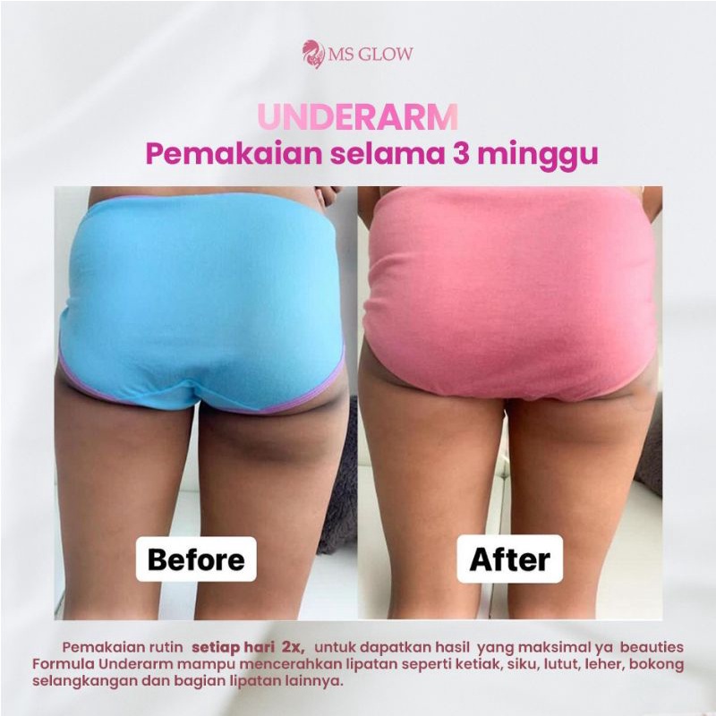 UNDERAM MS GLOW BANTU MENCERAHKAN KELIPATAN CERAH ALAMI TERMURAH DAN TERLARIS READY UNDERAM MURAH