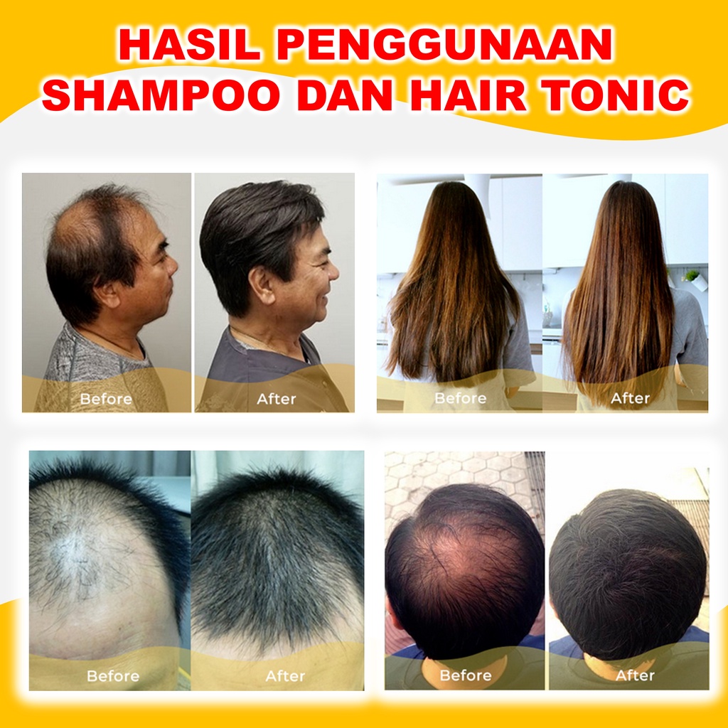 Sampo Rontok Parah Dan Ketombe Penyubur Penumbuh Rambut Ginseng Paling Ampuh BPOM 250 ml B1Q