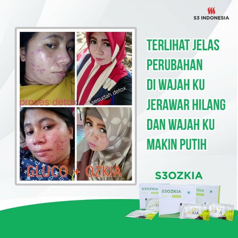 OZKIA S3 INDONESIA/ S3OZKIA