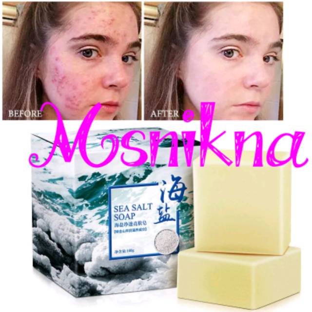 Fonce Korean Sea Salt Soap