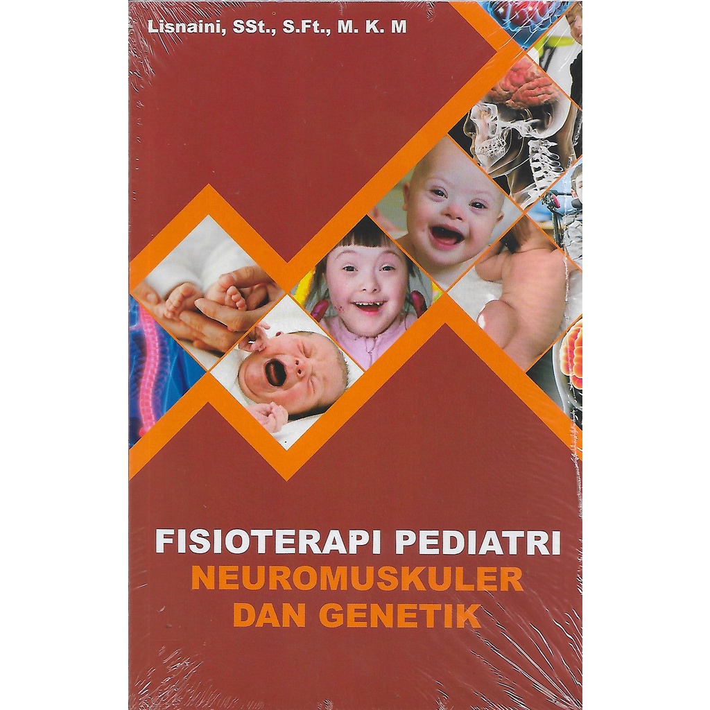 FISIOTERAPI PEDIATRI NEUROMUSKULER & GENETIK  -UR