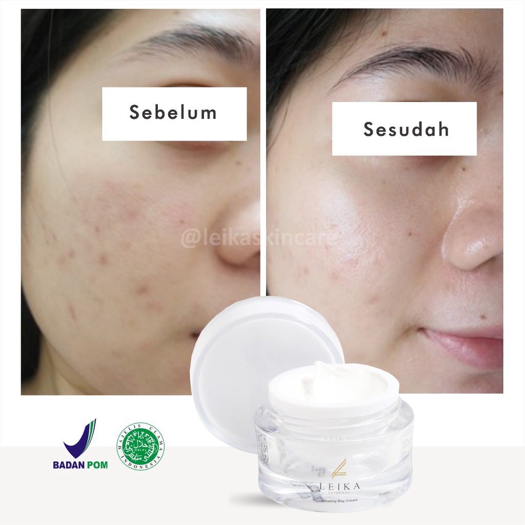 Menakjubkan! Krim Pelembab Wajah Kering dan Berminyak [Ampuh!] Cream Pelembab Wajah Jerawat jadi Glowing / Glowing Day Cream Leika Skincare 10gr Cream Pelembab Glowing Aman Ampuh Original BPOM Halal MUI