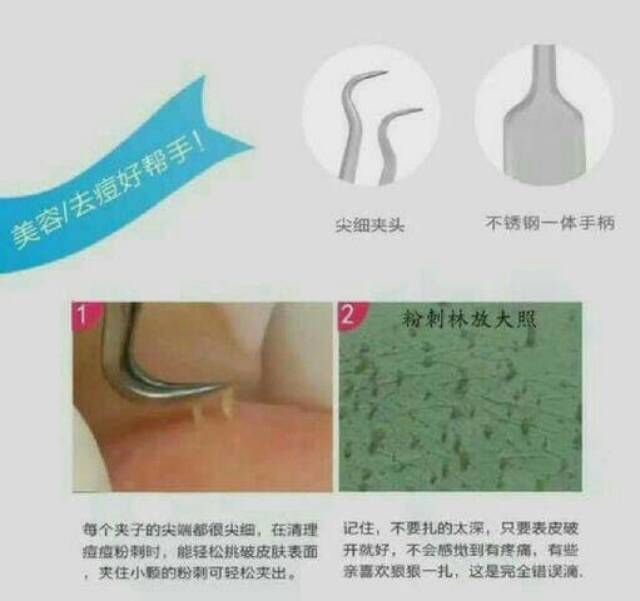 PINSET JEPIT PENCABUT KOMEDO JERAWAT / BLACKHEAD ACNE TWEEZER