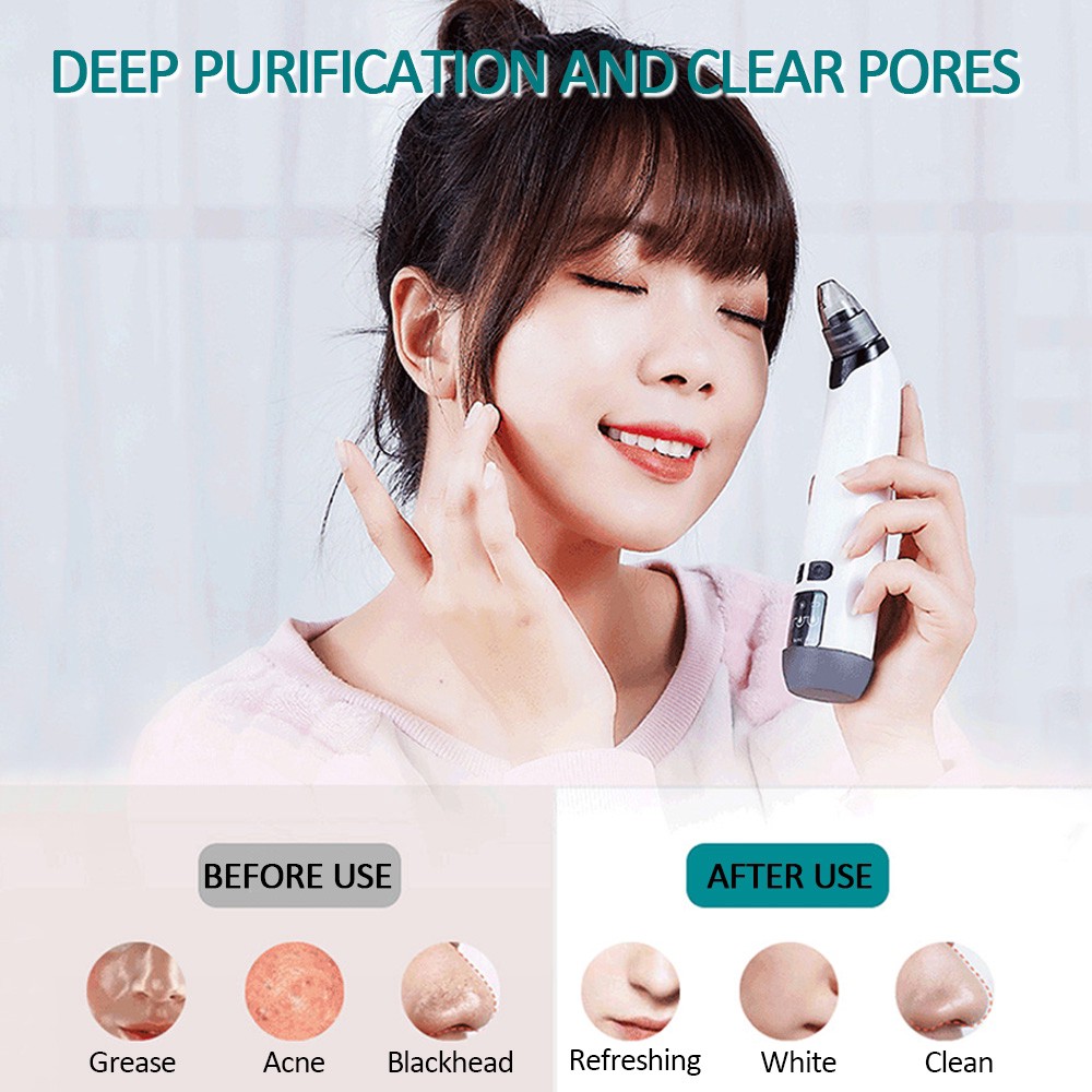 Alat Penyedot / Vaccum Komedo Microcrystalline Remove Blackhead Komedo