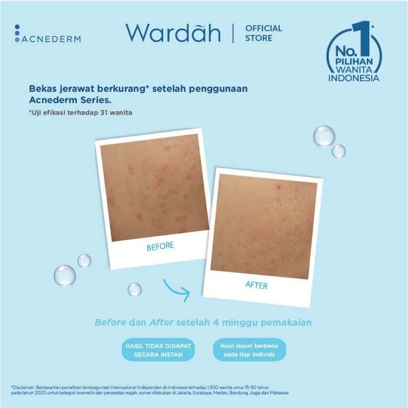 WARDAH ACNEDERM PURE FOAMING CLEANSER 60ML