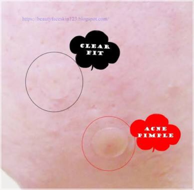 [BPOM] Cosrx Clear Fit Master Patch isi 18pcs