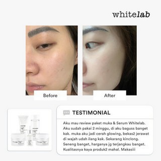 DOMMO - D8064 WHITELAB Brightening Series Face Body Serum | Facial Wash | Day Night Cream