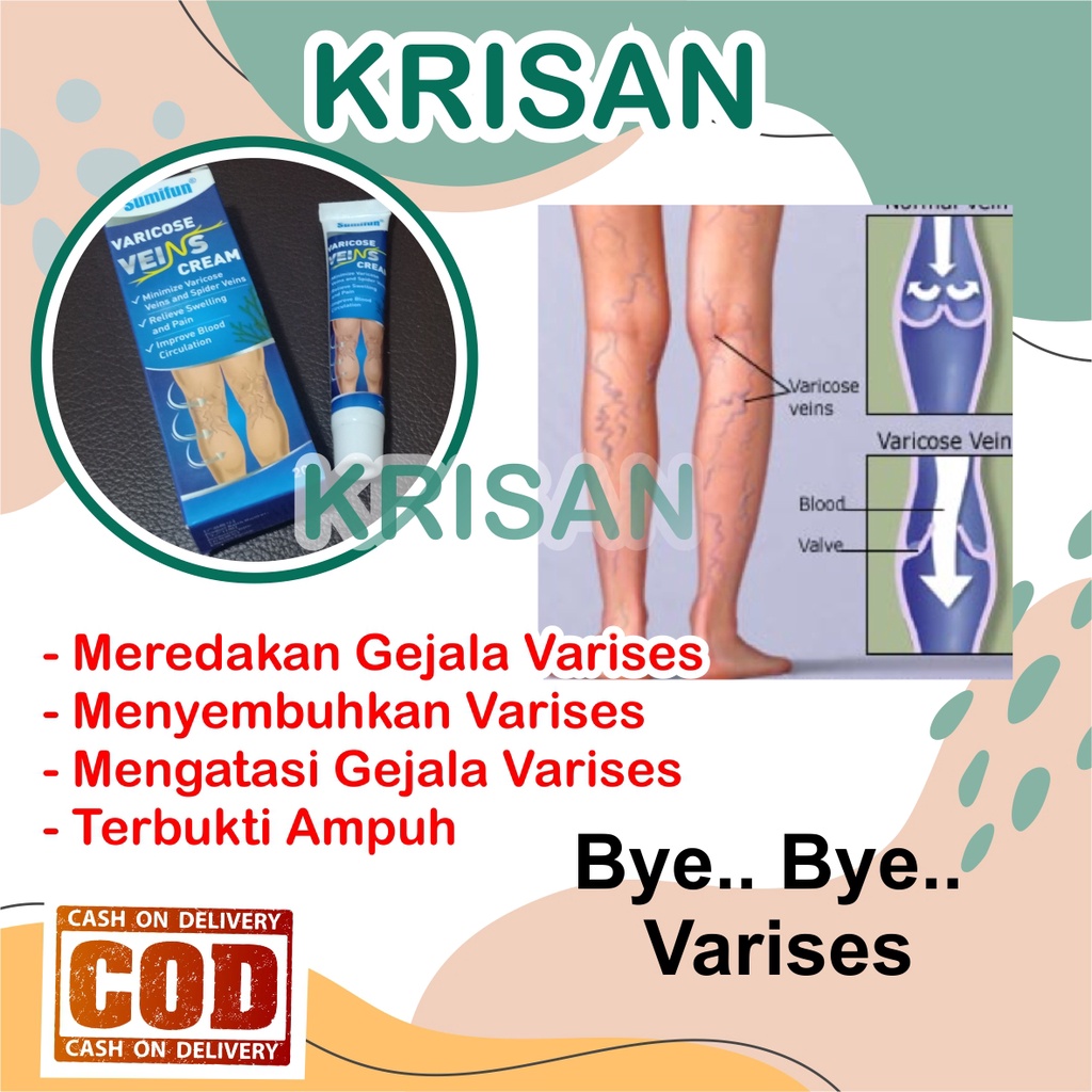 Jual Krisan Cream Krim Salep Obat Varises Salep Penghilang Varises