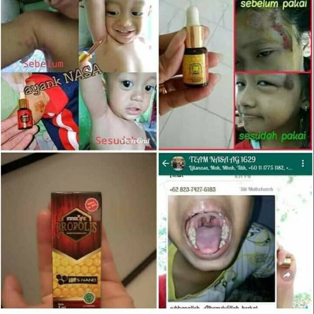 

SUPER NANO PROPOLIS (SUNPRO)