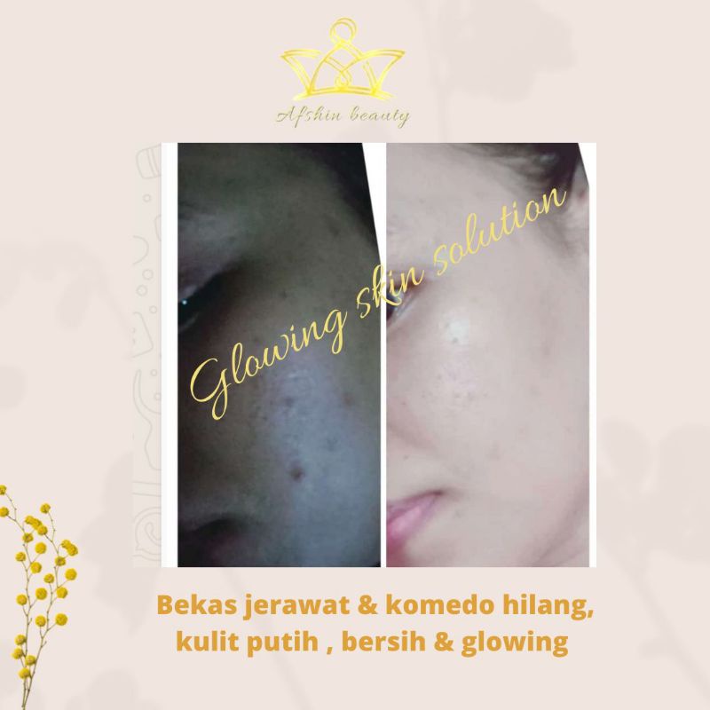 READY GLOWING SKIN SOLUTION , (AGEN SLAWI ) BPOM (ORIGINAL 100%) BIKIN WAJAH GLOWING PUTIH - PENGHILANG FLEK HITAM