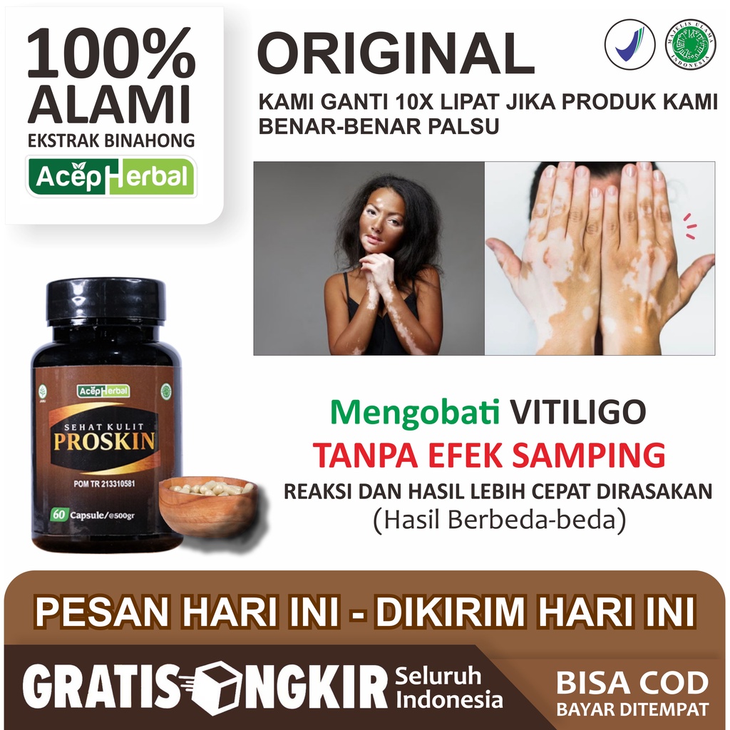 Penghilang Vitiligo Kulit Belang Bercak Putih pada Anak dan Dewasa Herbal Menghilangkan Vitiligo Sup