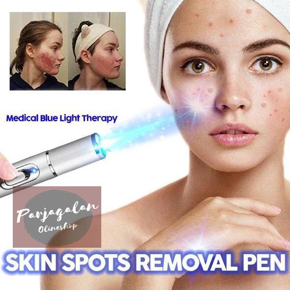 Skin Spots Removal Pen - Laser wajah / Pembersihi Wajah