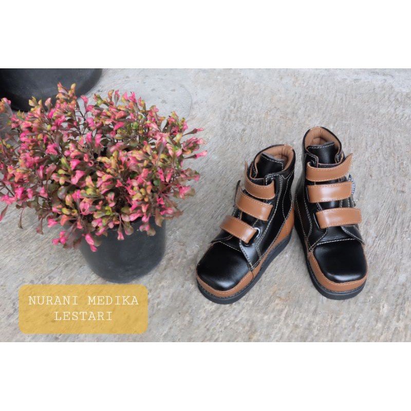 Sepatu Koreksi Orthopedi CTEV Flatfoot