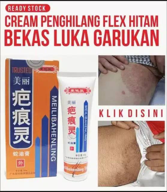 Penghilang Bekas Luka Bekas Koreng Bekas Gatal Dll Ori Meilibahenling Salep Cina Ampuh Shopee Indonesia