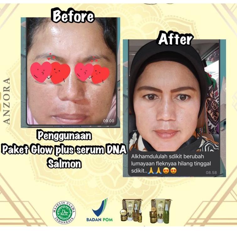 38r>< Anzora Skin Care Glow Series/GRATIS HADIAH