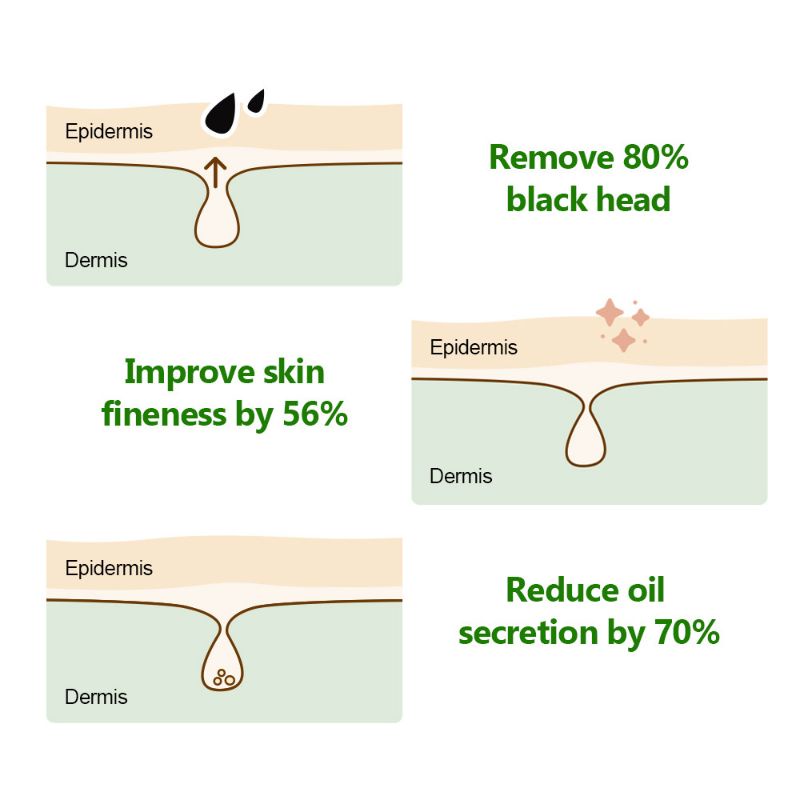 SACE LADY Korean Blackhead Removal Nursing Serum 100% Organic Serum Pencabut Komedo Hidung Bahan Organik Set Original Bukan Breylee