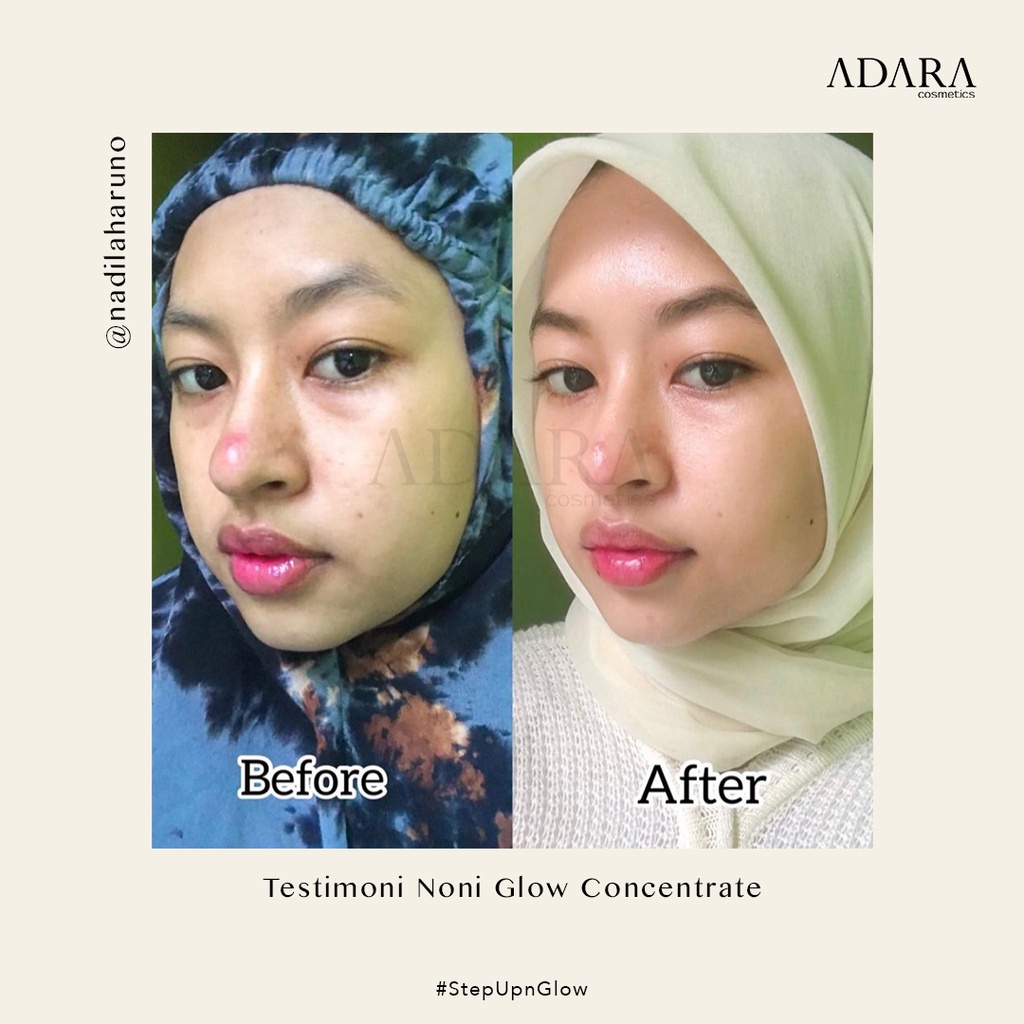 ADARA Noni Glow Concentrate 20mL