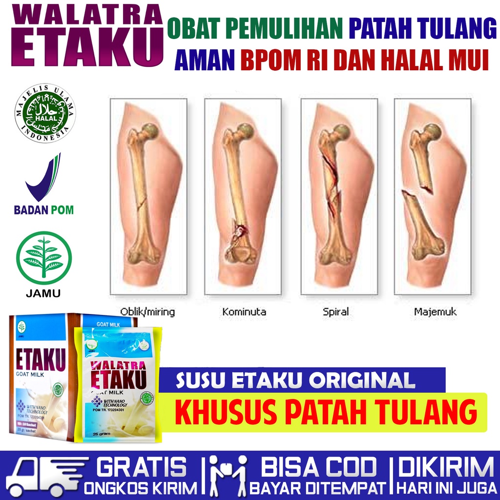 Obat Pemulihan Patah Tulang - Penyembuhan Patah Tulang - Patah Tulang Kaki - Patah Tulang Tangan - S