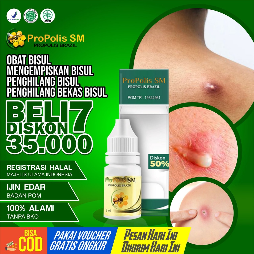 Obat Bisul - Mengempiskan Bisul Penghilang Bisul Penghilang Bekas Bisul - PROPOLIS SM