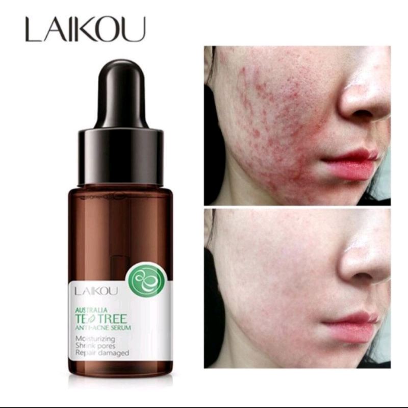 Serum Wajah LAIKOU TEA TREE  Serum Ekstrak Tea Tree -Anti Jerawat -Whichone.id
