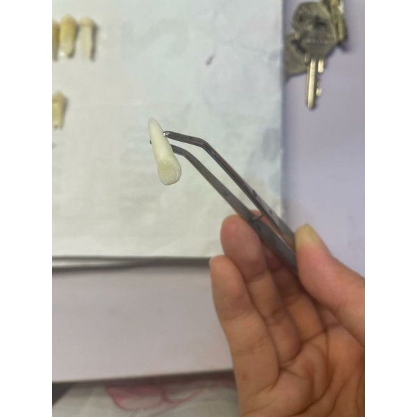 gigi decidui atau gigi sulung / gigi susu insisivus dengan akar. bukav molar anak susu