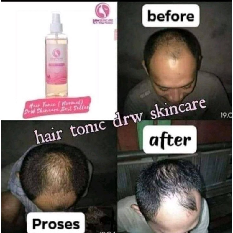 HairTonic @DRW SKINCARE PRODUK ORIGINAL 100% BPOM Drw skincare