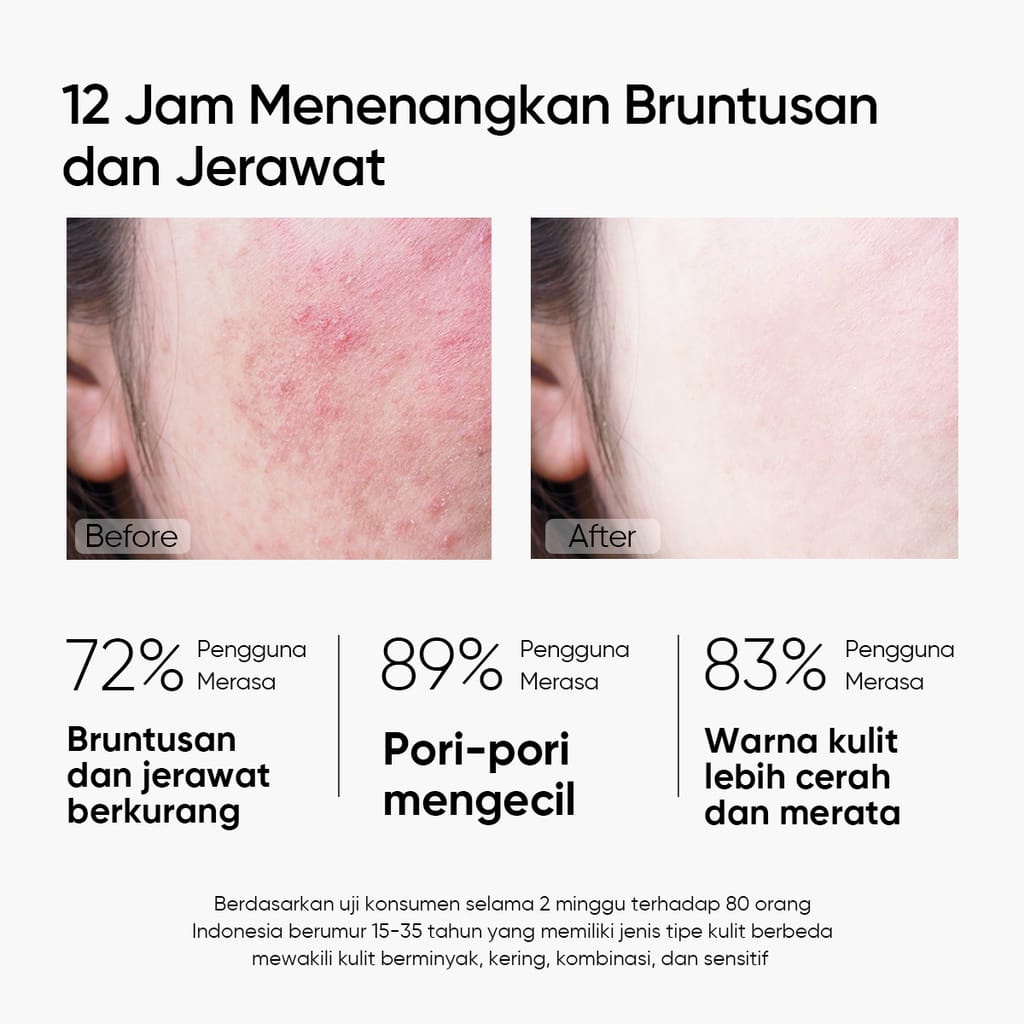 [BPOM] Skintific Mugwort Anti Pores &amp; Acne Clay Mask Pore Clarifying Wask Off Pack 55gr