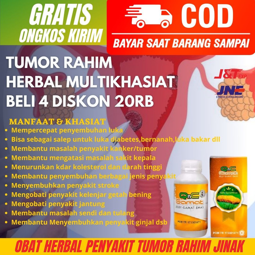Obat Tumor Rahim Jinak-Kanker Rahim-Obat Herbal Kanker Jinak Ganas-Tumor Anak Dewasa- QnC