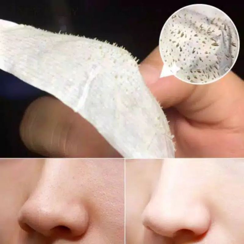 SACE LADY DEEP Cleansing Hapus Blackhead