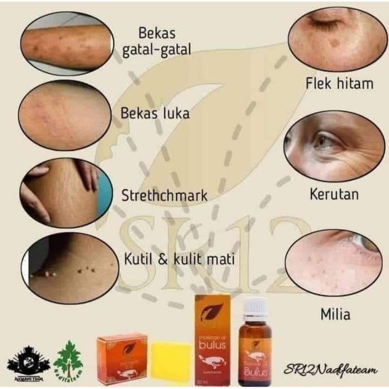 MINYAK BULUS SR12 BEST SELLER!! MINYAK BULUS ORIGINAL / MASSAGE OIL BULUS SR12 / BPOM DAN TIDAK AMIS / TREATMENT PERAWATAN WAJAH DAN TUBUH