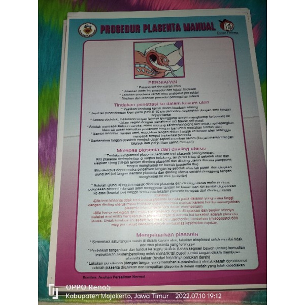 

Poster Prosedur Plasenta Manual New Design 2024