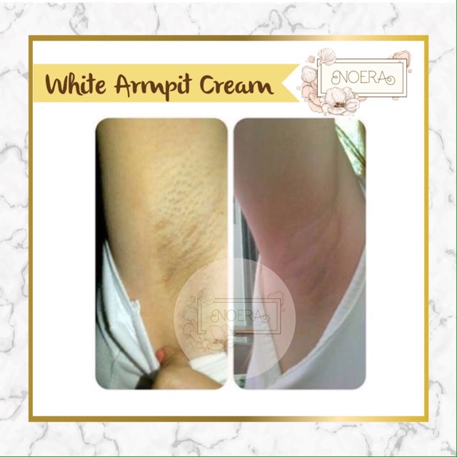 Noera Skin Lightening Cream | Armpit Cream Pemutih Lipatan Pemutih Ketiak Pemutih Selangkangan - BPOM