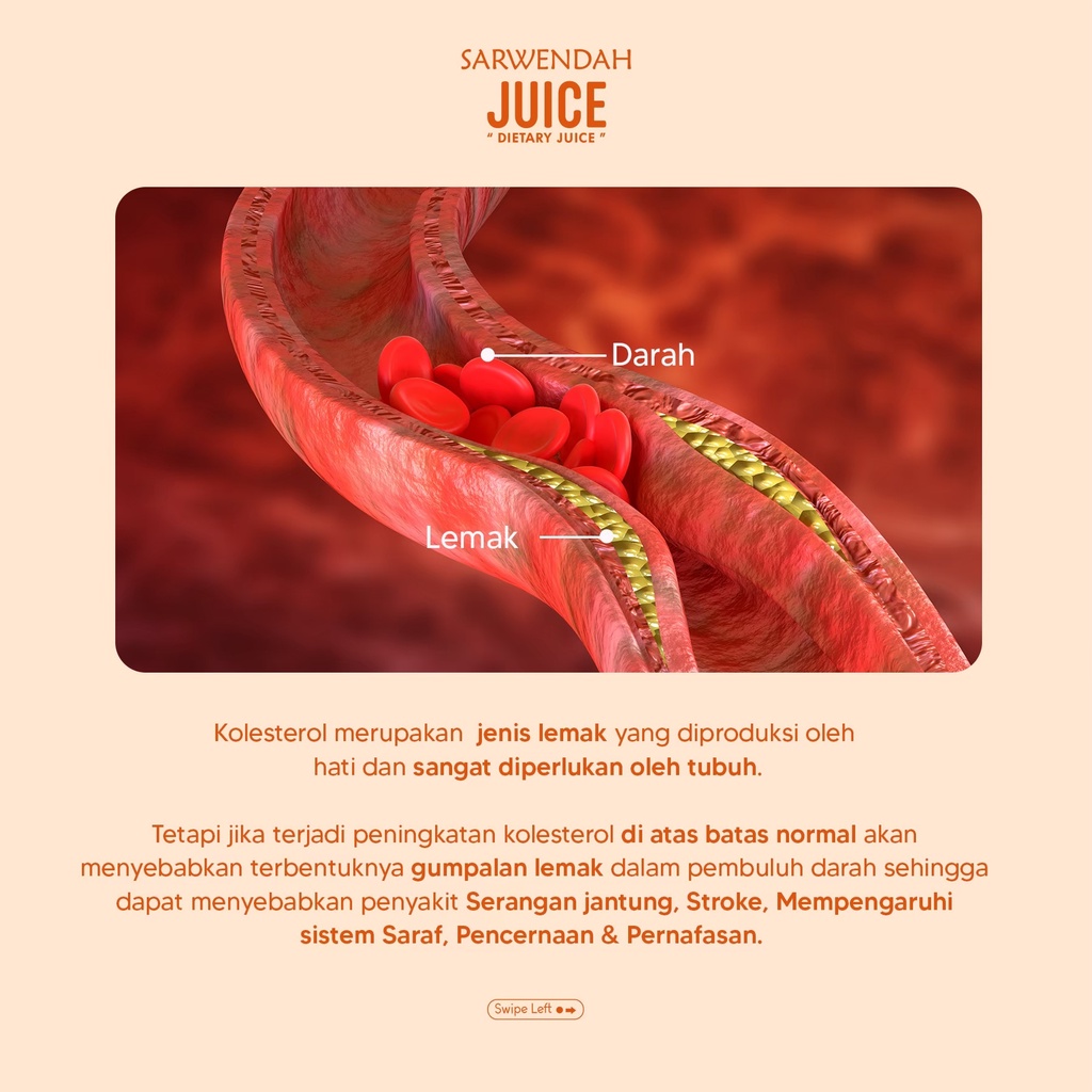 JUS PENURUN KOLESTEROL / DIABETES / ASAM URAT / KENCING MANIS / DARAH TINGGI / STRESS / KISTA - BISA MEMBANTU MENINGKATKAN KEBERHASILAN PROGRAM HAMIL - PEREDA SAKIT HAID - JUS BAWANG SARWENDAHJUICE - JUS SARWENDAH BPOM