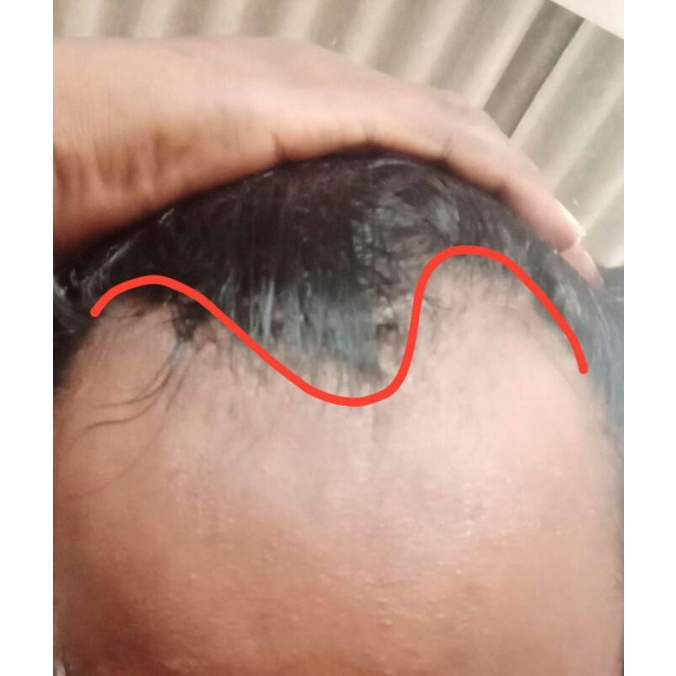 tope penutup botak depan custom request ukuran