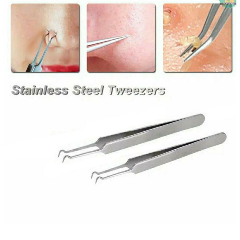 Pinset Komedo jerawat Stainless stell