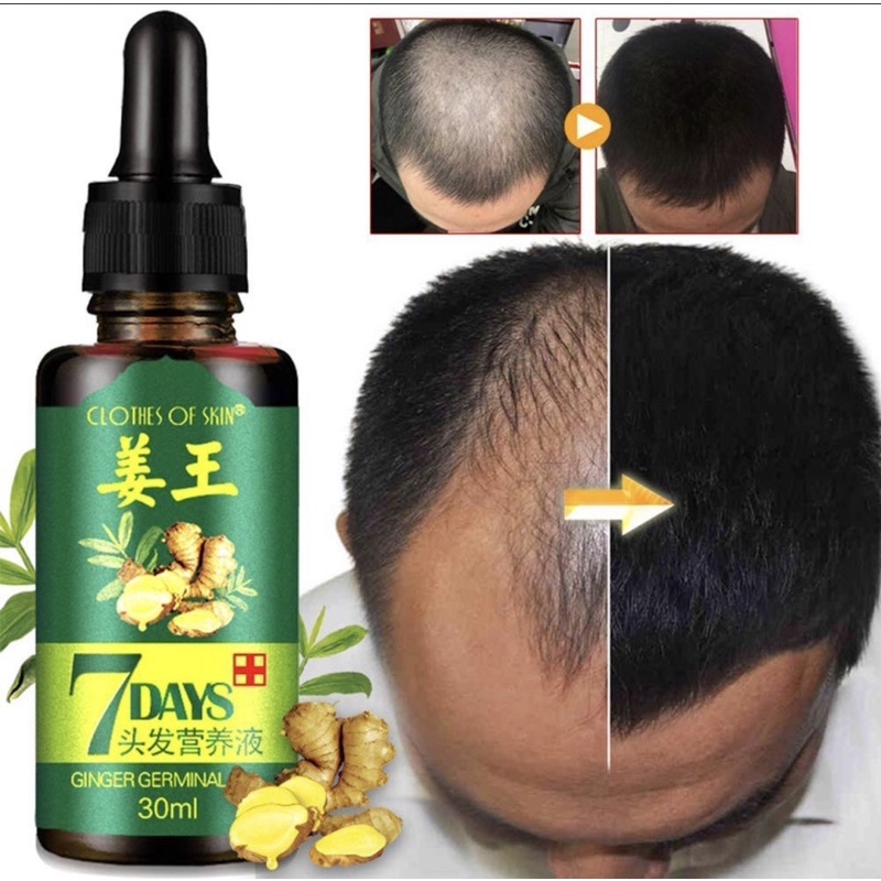 7 Days Clothes Of Skin Ginger Germinal Oil Minyak Penumbuh Rambut